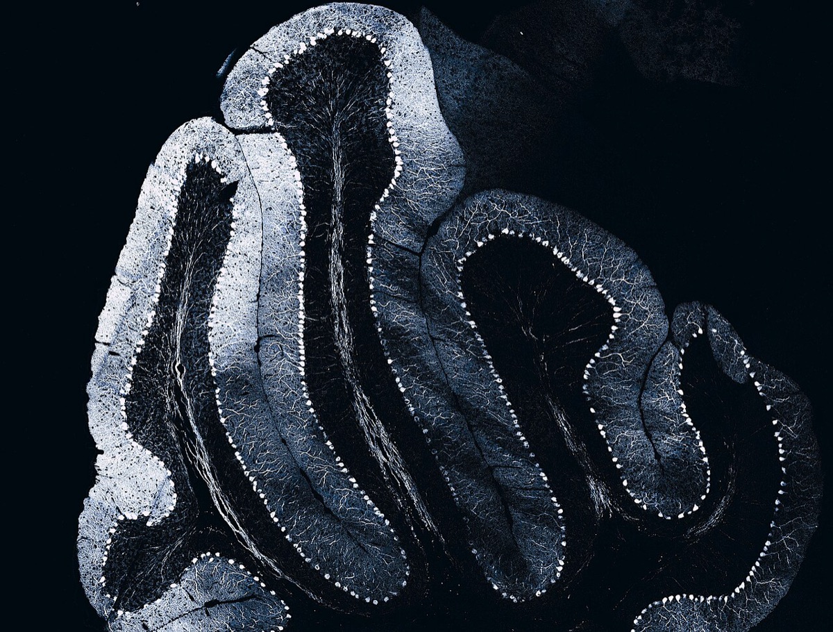 Folds of a mouse cerebellum under a confocal microscope, silver on black